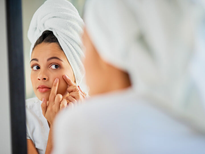 Comment traiter efficacement l'acné avant son mariage ?