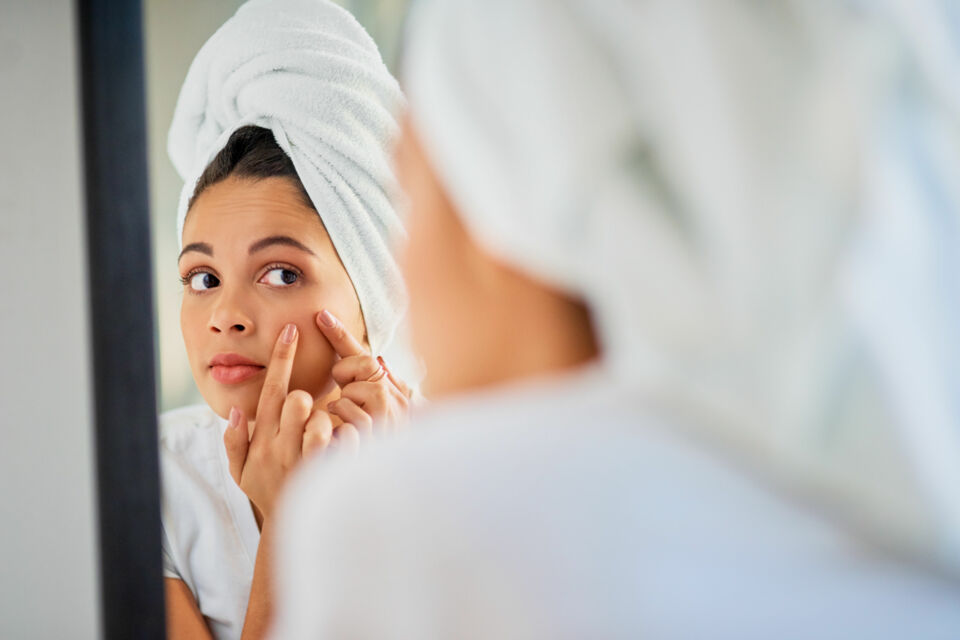 Adobe Stock - Photo d'illustration - Traiter l’acné avant son mariage nécessite une approche patiente et bien pensée. N'oubliez pas que la clé du succès réside dans la régularité des soins et dans une approche globale alliant santé de la peau, bien-être mental et habitudes de vie équilibrées.