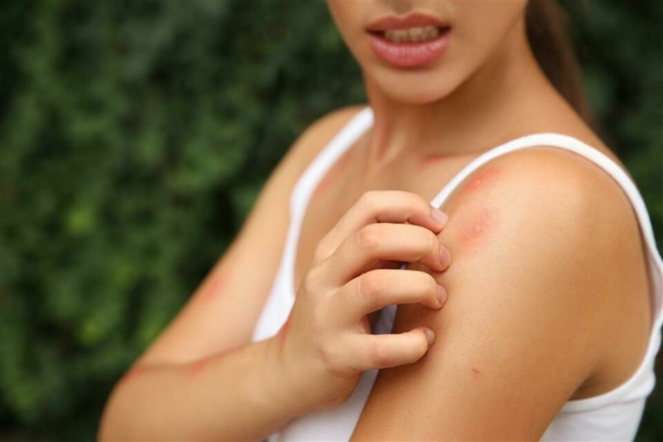 Adobe Stock - Photo d'illustration - Dites oui à l’été… pas aux moustiques ! Grâce à ces astuces naturelles et malines, organisez un mariage ensoleillé sans piqûres, pour que l’amour reste le seul frisson de la journée.